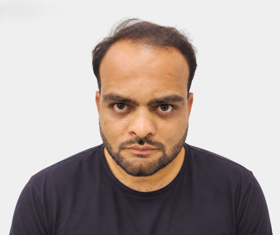 Before