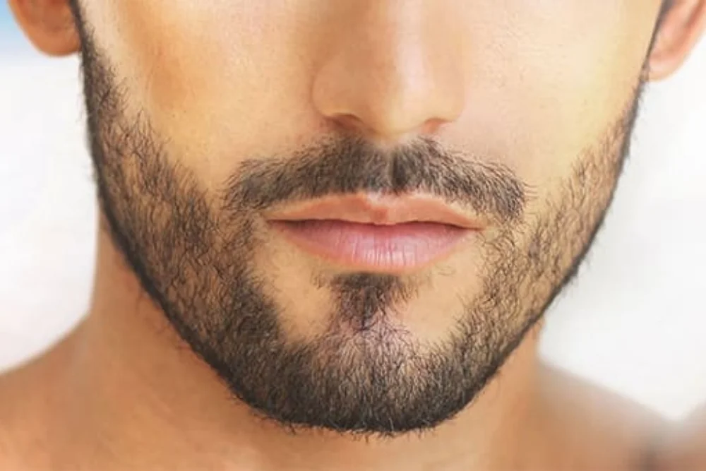 What is a Moustache Hair Transplant?
