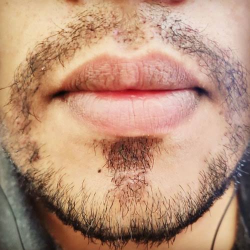 Moustache Hair Transplant in India