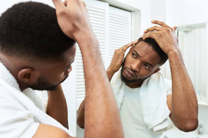 Afro Hair Transplant