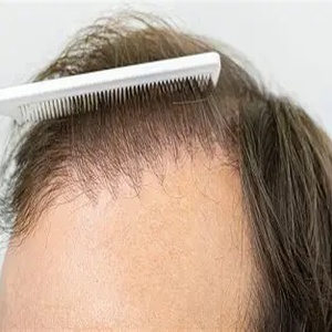 Natural Results.
