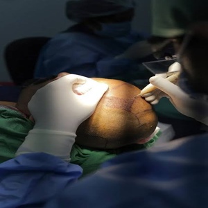 Natural, Long-term Results.